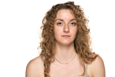 beautiful young blond women with long curly hair and problematic skin.の写真素材