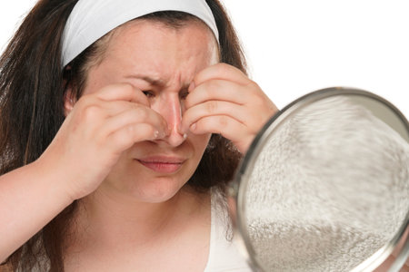Nervous chubby woman with headband squeeze pimples on her nose.の写真素材