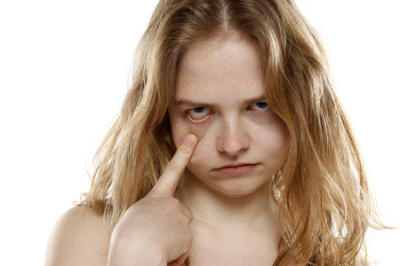 woman pulliing her lower eyelid with her finger on white studio backgroundの写真素材