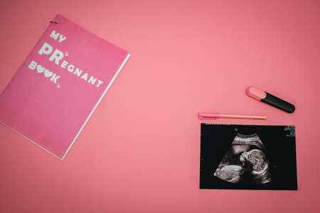 Ultrasound image of a baby, markers and pregnant book on a pink background. Flat-lay, top view with place for your text. Medical trends and concept.の写真素材