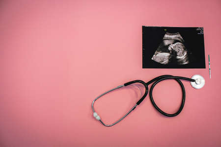 Stethoscope, ultrasound image of a baby and a pregnancy test on a pink background. Flat-lay, top view with place for your text. Medical trends and concept.の写真素材