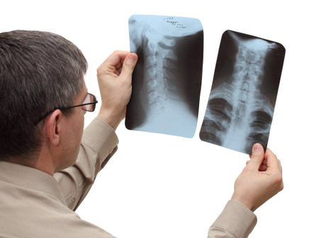 young man holding x-ray pictures in his hands and looking at them, isolated on white background