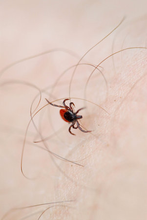 Tick