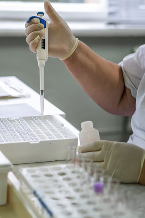 Laboratory equipment for blood analysis. The real work of the laboratory assistant in the hospital....