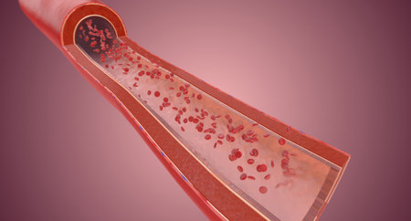 Artery with high blood pressure 3D renderingの写真素材
