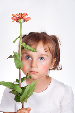 Little girl with atopic dermatitis symptom on skin of cheeks holding the flower. Pollen allergy.の写真素材