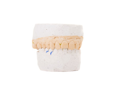 Series. teeth plaster cast. Close up on white background