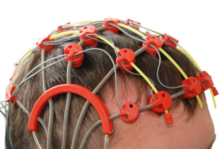 epilepsy examination