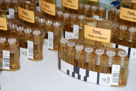 test-tubes