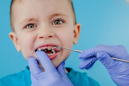 Small patient does not want to open the dentist's mouth on blue background. Dantist treats teeth. close up view of dentist treating teeth of little boy in dentist officeの写真素材