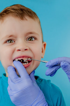 Small patient does not want to open the dentist's mouth on blue background. Dantist treats teeth....