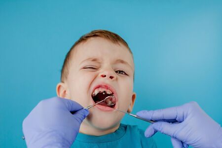 Close up of dentist's hands with assistant in blue gloves are treating teeth to a child, patient's face is closed.の写真素材