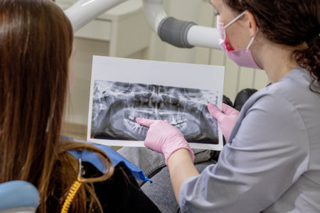 Dentist explaining the details of a x-ray teeth picture to his patient in clinic. Oral care, orthodontics.の写真素材