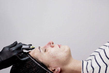 Face mesotherapy procedure in a beauty salon. Beautician doctor makes injections into the skin of...