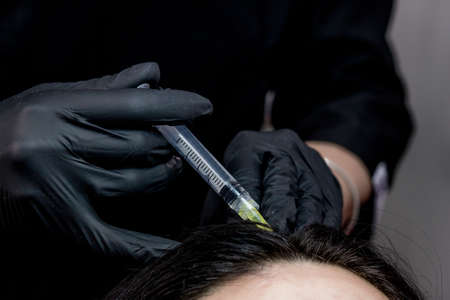 Needle mesotherapy. cosmetologist makes injections in woman head. strengthen the hair and their growth.の写真素材