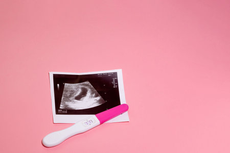 Photo of ultrasound and pregnancy test on a pastel pink background. Positive pregnancy testの写真素材