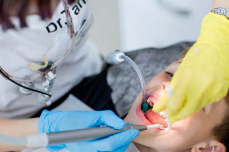 Children's dentistry. First examination at the dentist. A cute handsome boy with his mouth open is looking aside while the doctor is treating his teethの写真素材