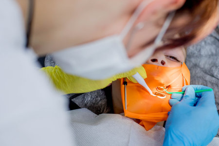 Children's dentistry. First examination at the dentist. A cute handsome boy with his mouth open is looking aside while the doctor is treating his teethの写真素材