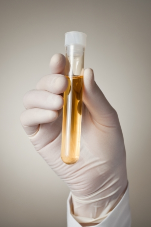 Doctor holding a bottle of urine sampleの写真素材