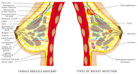 Breast Anatomy. Female breast anatomic cross section for basic medical education, for clinics & Schools. Set with woman bust. Different Types of Breasts on a white background.のイラスト素材