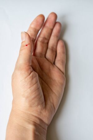 a finger on his hand was accidentally wounded with a knifeの写真素材