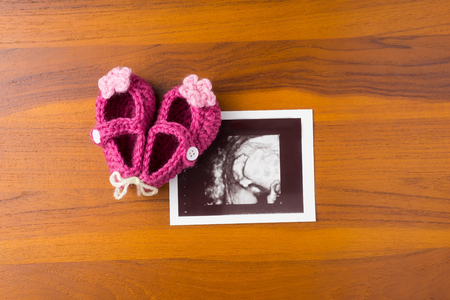 photo of ultrasound baby foot with cute pink wool shoe on wood desktopの写真素材