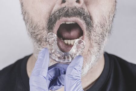 Hand with blue glove holding a dental splint, facing an adult man with his mouth ajarの写真素材