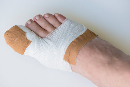 Toe on the big toe in the hospital