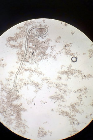 A detailed view reveals the intricate life within a tiny ecosystem, showing casing slender worms interacting with microorganisms in a vibrant microworld teeming with life.の写真素材