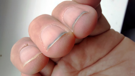 Fingers display noticeable dirt and grime accumulation under the nails, suggesting recent outdoor labor. The hand appears weathered and in need of cleaning after working hard.の写真素材