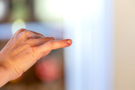 Wounded finger of a woman's hand