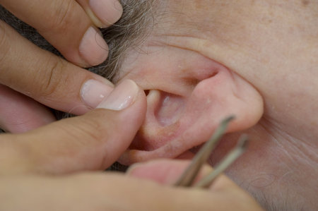 application of seed in the ear -- Auricular Seed Treatment