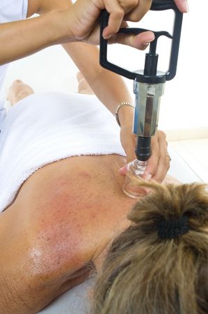 woman receiving an massage by Vacuum treatment methodの写真素材