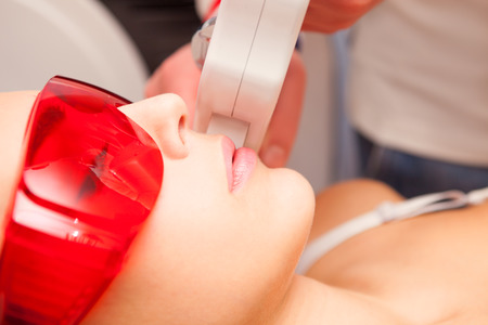 woman upper lip laser epilationの写真素材