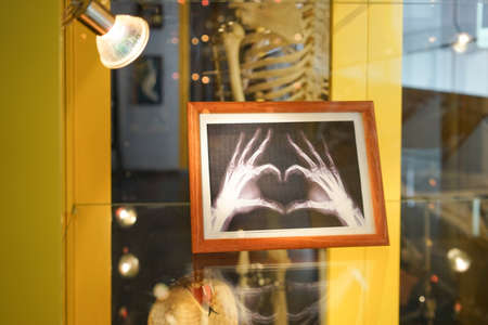 Zelenogradsk, Russia-may 17, 2016: the skeleton Museum is a city landmark.のeditorial素材