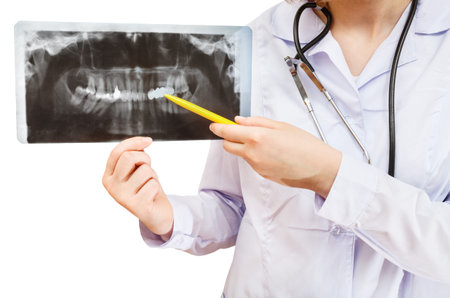 nurse points X-ray picture with human jaw isolated on white background
