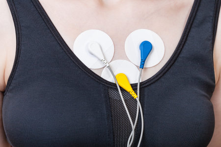 electrodes of Holter monitor of electrocardiogram are attached to chest