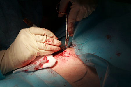 surgeon stitches the wound after the neoplasty
