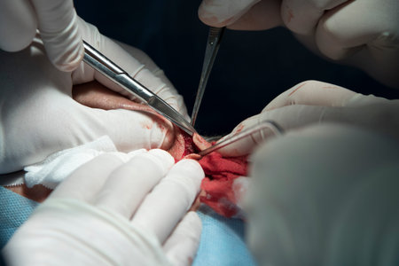 plastic surgery close-up with nose bridge tissues cutting by surgical scissors