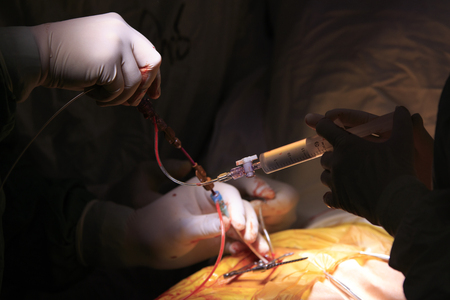 Surgeons administer the solution from syringe right into the heart through a long tubes during the surgery closeupの写真素材