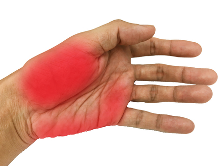 Inflame muscle on the hand ,Inflame muscle on the back handの写真素材