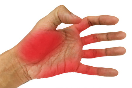 Inflame muscle on the hand ,Inflame muscle on the back handの写真素材