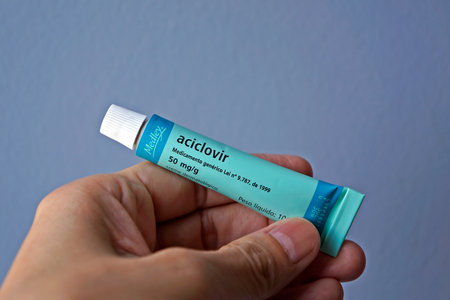 Rio de Janeiro, Brazil - January 23, 2021: Hand holding a Aciclovir cream tube, medicine used for herpes treatment. Powerful antiviral.のeditorial素材