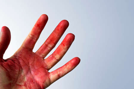 male hand covered in bloodの写真素材