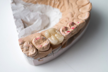 ceramic crowns in dental laboratory on white.の写真素材