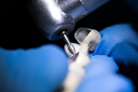 Dental prosthesis, dentures, prosthetics workの写真素材