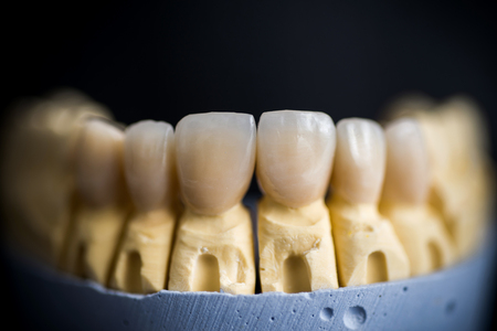 ceramic crowns in dental laboratoryの写真素材