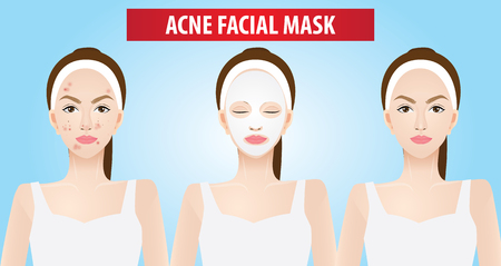 Facial mask removing acne vector illustrationのイラスト素材