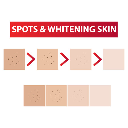 Spots skin to clear process and whitening tones vector illustrationのイラスト素材