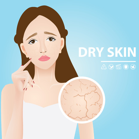 A woman with dry skin vector illustrationのイラスト素材